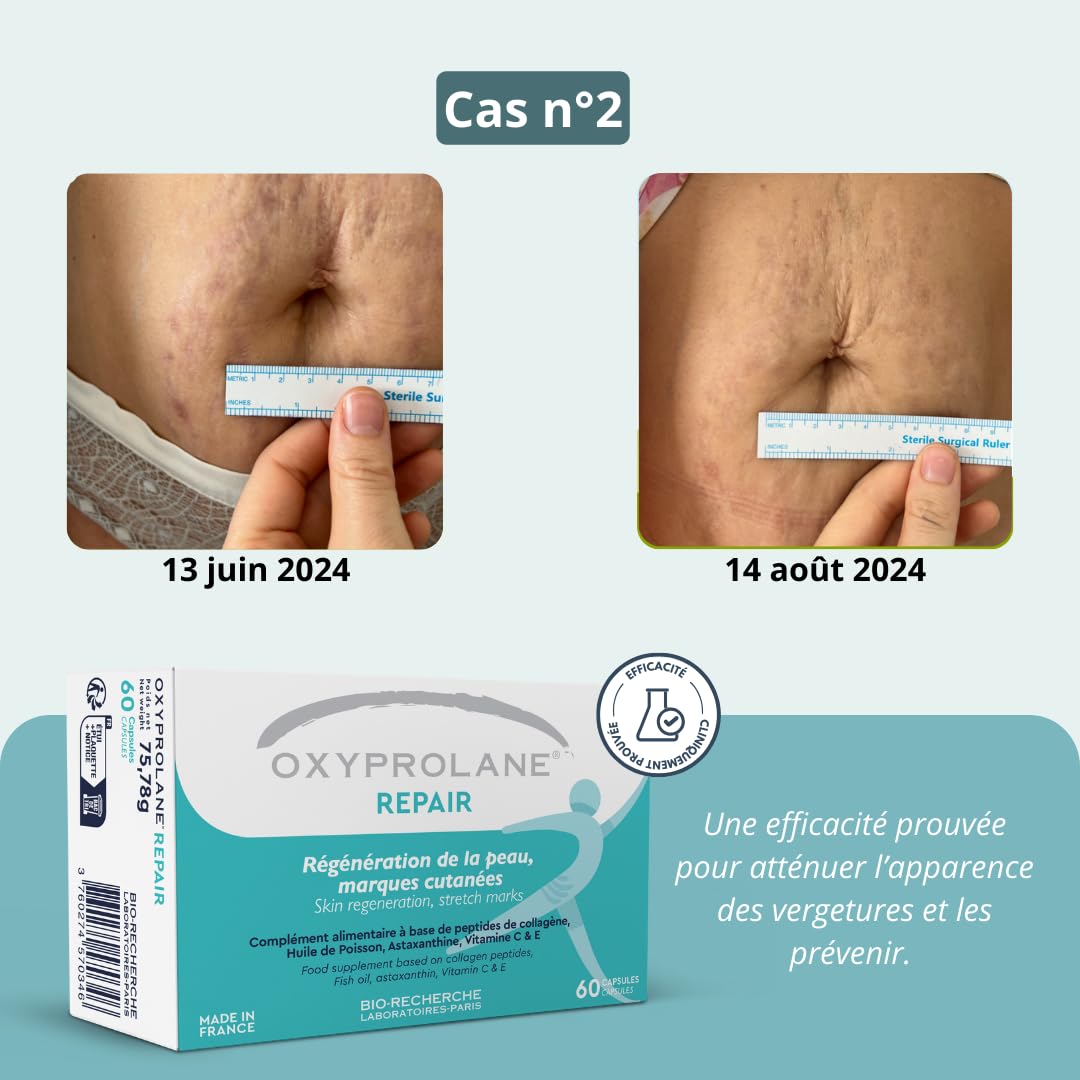Oxyprolane Repair – Complément Alimentaire Anti-Vergetures | Peau Élastique & Régénérée | Peptides de Collagène, Astaxanthine, Vitamine C & E | 60 Gélules | Beauté & Soin de la Peau
