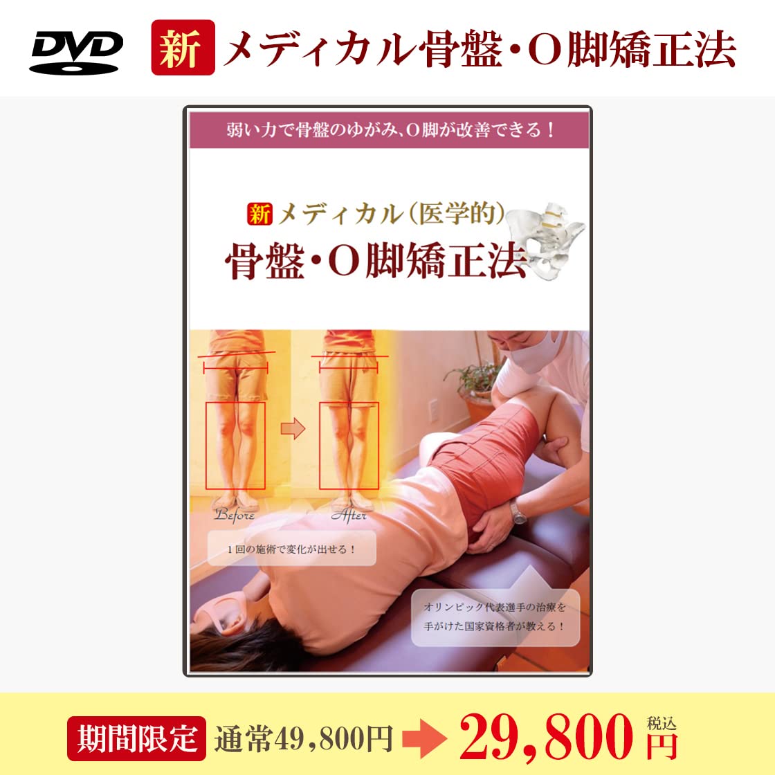 Amazon.co.jp: DVD新メディカル（医学的）骨盤O脚矯正法 : おもちゃ