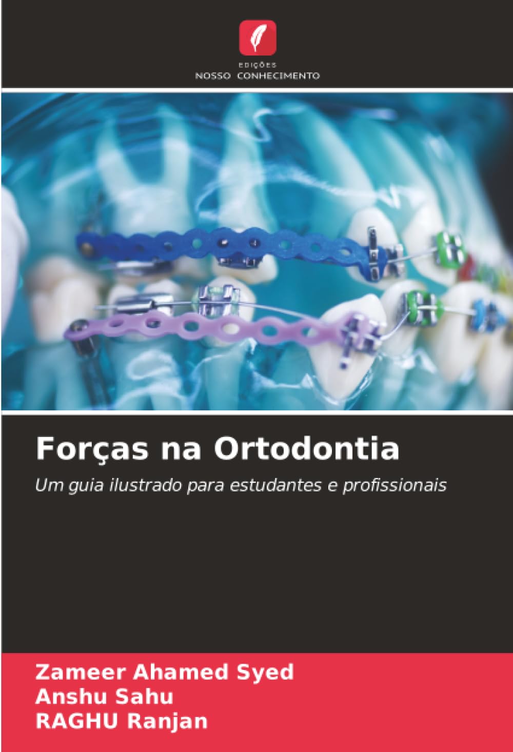 Forças na Ortodontia: Um guia ilustrado para estudantes e profissionais