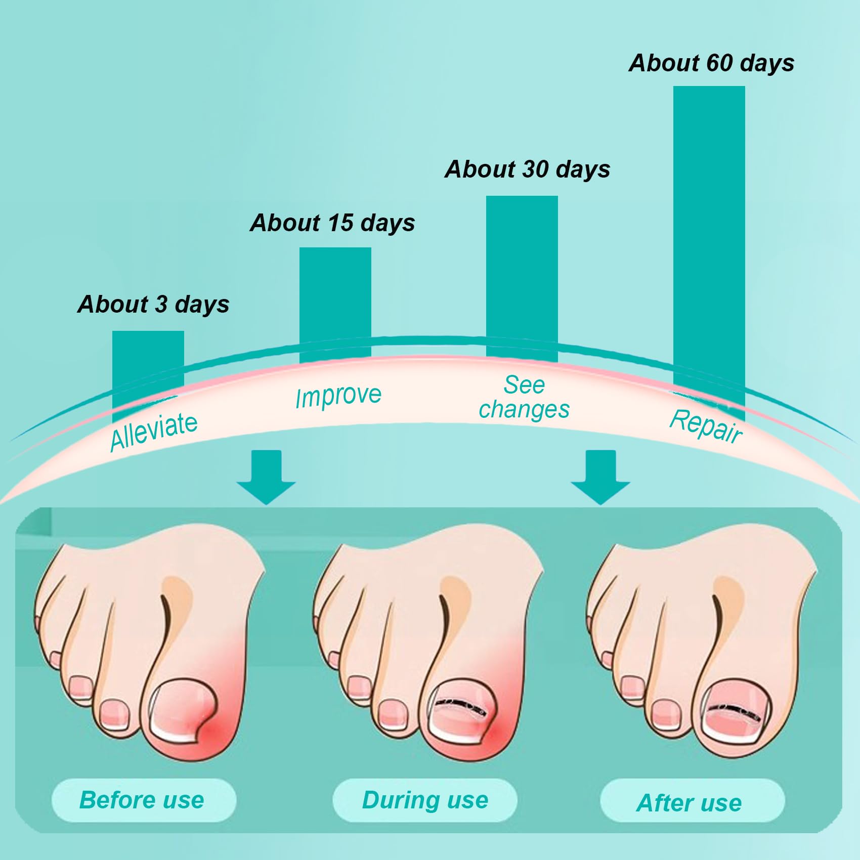 Ensemble Professionnel Pour la Correction des Ongles Incarnés : Patchs de Correction des Ongles et Outils Efficaces Pour Ongle Incarné