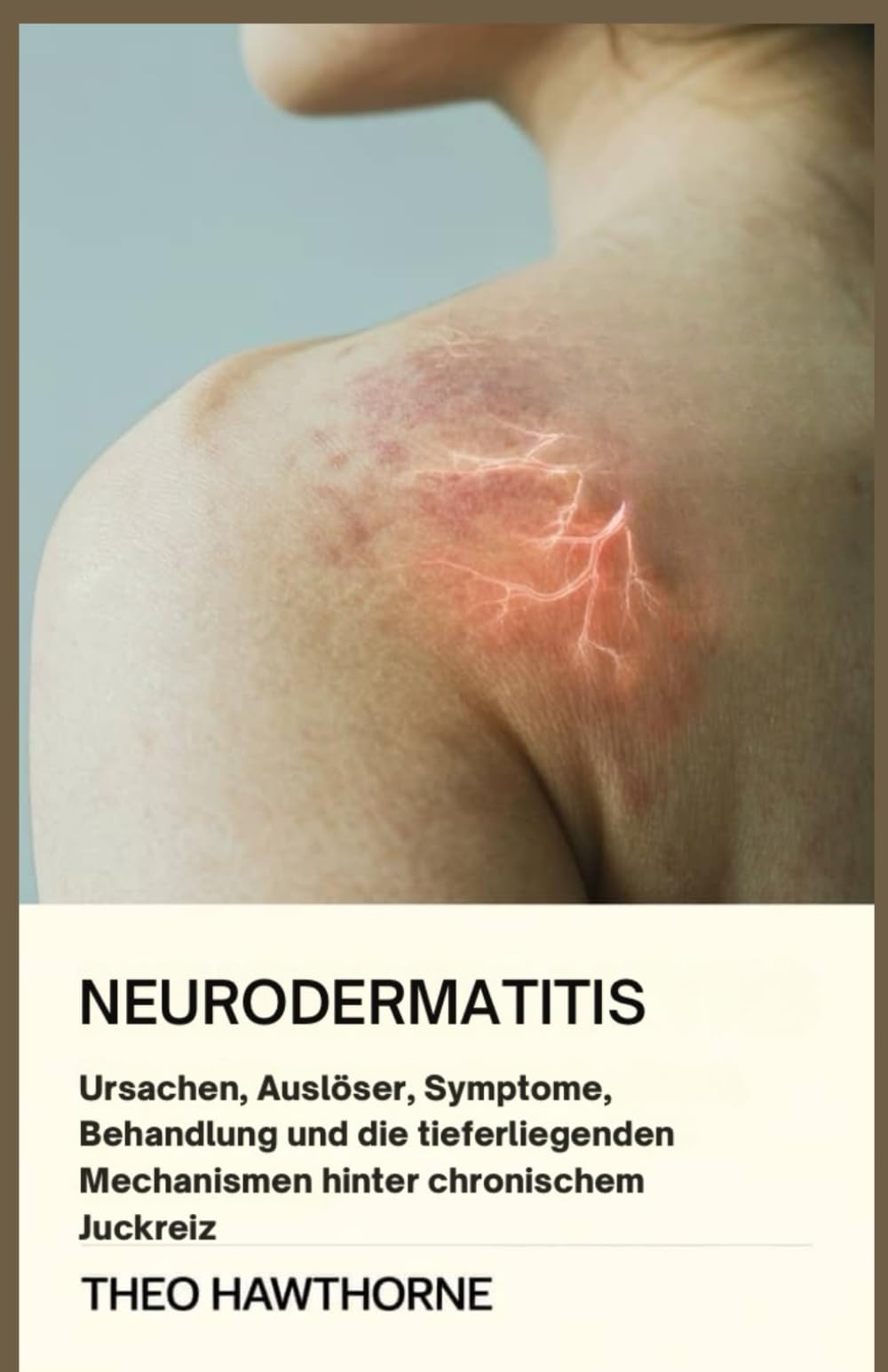 Neurodermatitis: Ursachen, Auslöser, Symptome, Behandlung und die tieferliegenden Mechanismen hinter chronischem Juckreiz