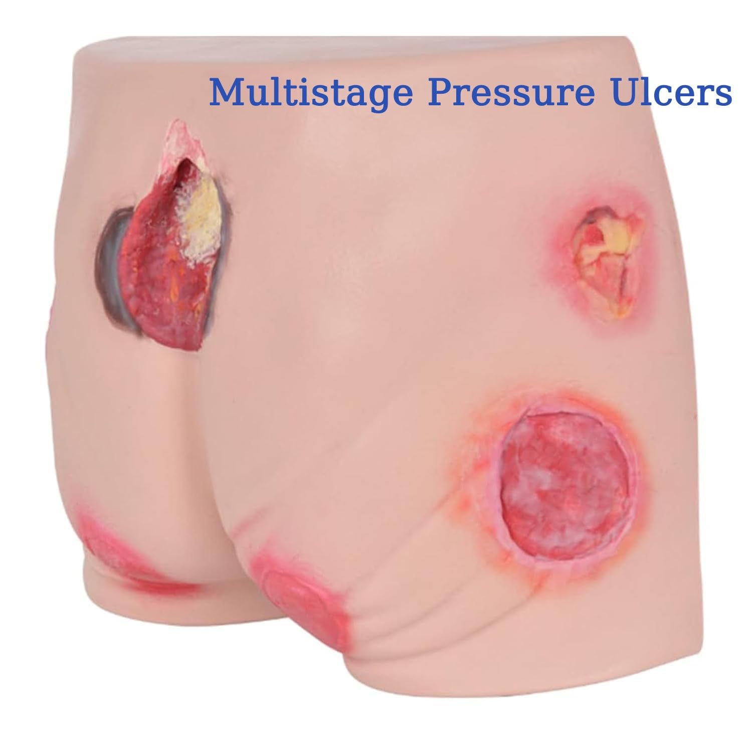 Modèle de soins pour ulcères de pression, simulateur avancé d'escarres pour formation d'évaluation des soins des plaies, simulation d'ulcère en 4 étapes pour l'éducation médicale