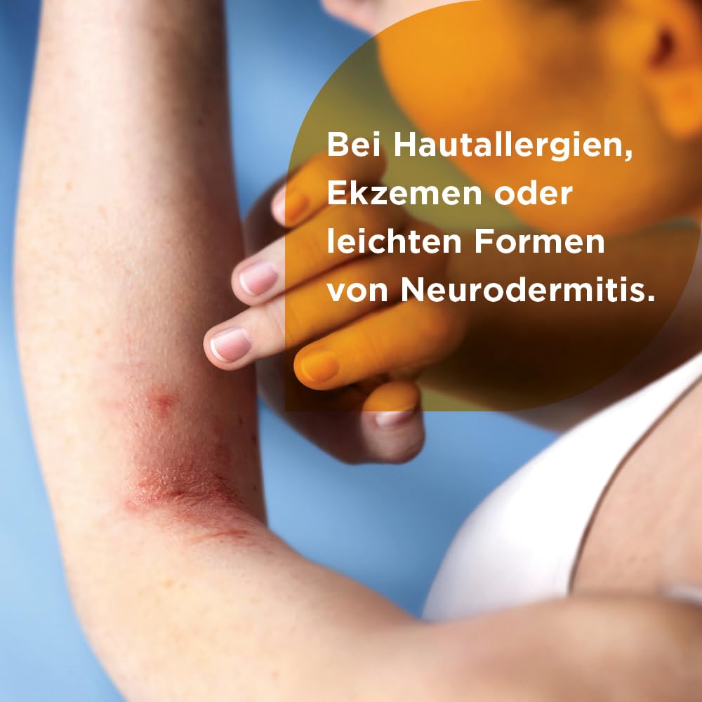 Soventol HydroCort 0,5% Creme 2x 30 g bei akuten Hautentzündungen wie Neurodermitis, Hautallergien & Ekzemen - lindert Juckreiz - entzündungshemmend
