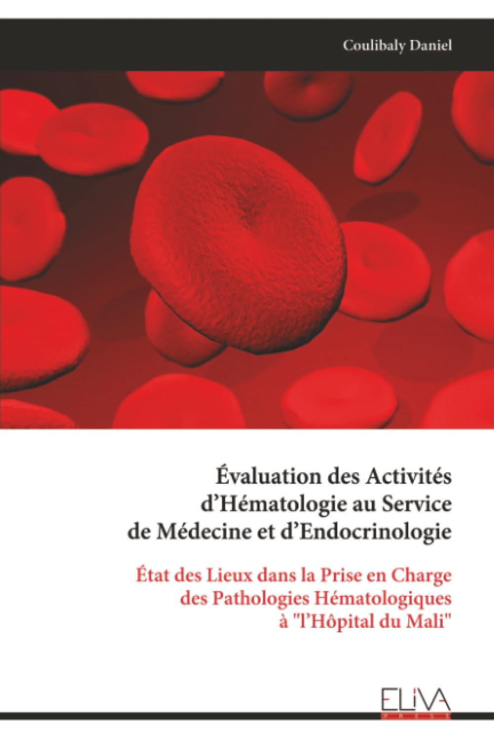 Évaluation des Activités d’Hématologie au Service de Médecine et d’Endocrinologie: État des Lieux dans la Prise en Charge des Pathologies Hématologiques à "l’Hôpital du Mali"