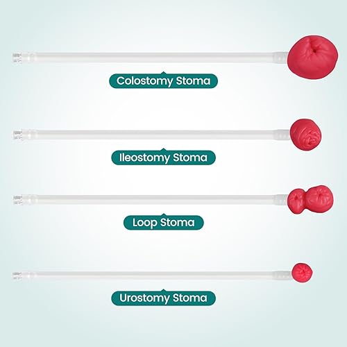 Miniatura 2 de Kit de entrenamiento de cuidado de ostomía portátil, modelos de estoma para educación médica, kit de modelo de práctica de ostomía para demostración