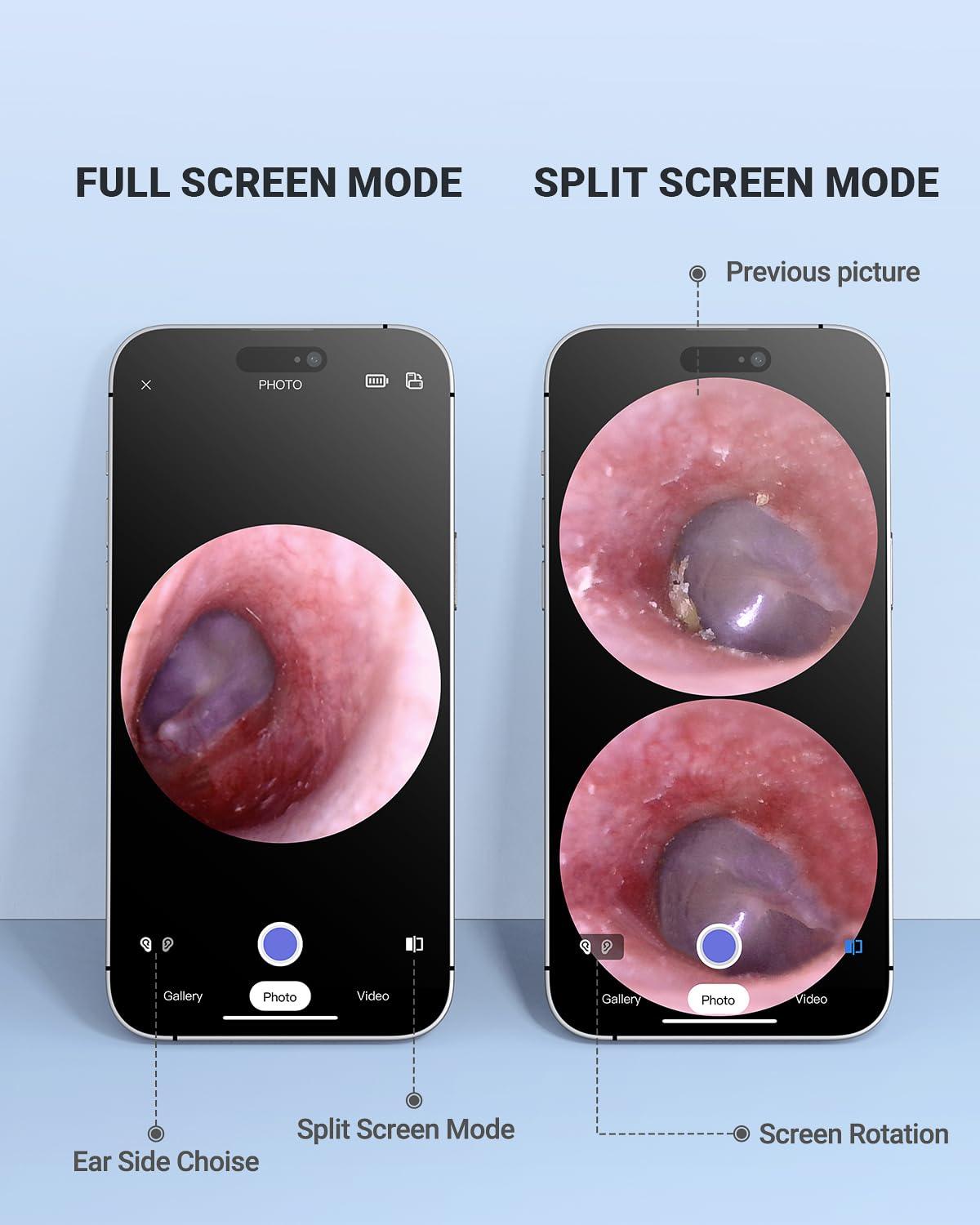 Kabelloses Otoskop mit Gyroskop, Ohrkamera mit Dual-View, 3,9 mm Otoskop mit Licht, Ohrenschmalz-Entfernungswerkzeug für Kinder, Erwachsene und Haustiere, kompatibel mit iPhone und Android