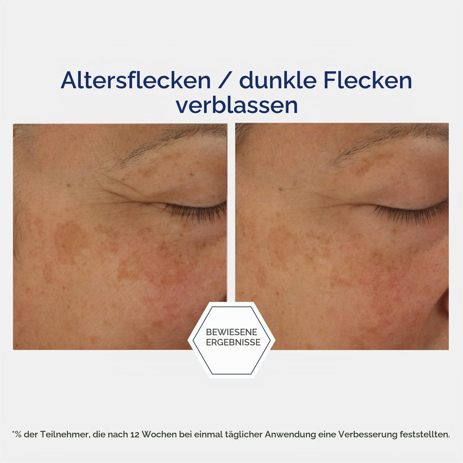 Neostrata Skin Active Potent Retinol Complex