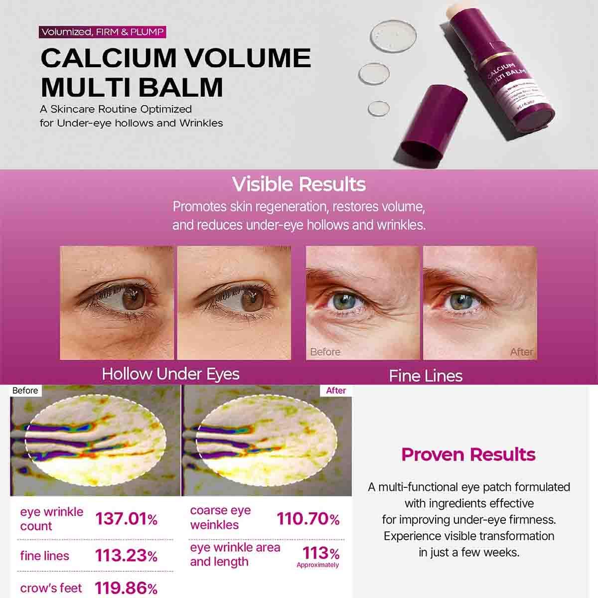 Calcium Multi Balm,Balsamo Multiuso Al Calcio,Balsamo Multi Rughe,Stick Volumizzante Antirughe,Stick Idratante Al Collagene,Idratante e Rassodante,Adatto a Occhi,Collo,Viso (1 pz, 9g)