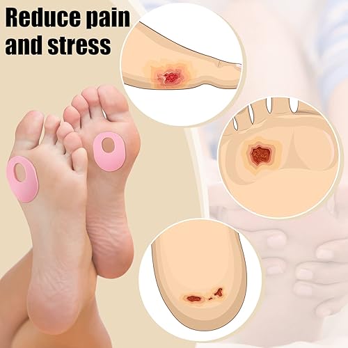 Miniatura 6 de Nuanchu 72 cojines de espuma suave para callos ovalados, almohadillas de maíz rosadas, autoadhesivas, almohadillas impermeables para el cuidado de