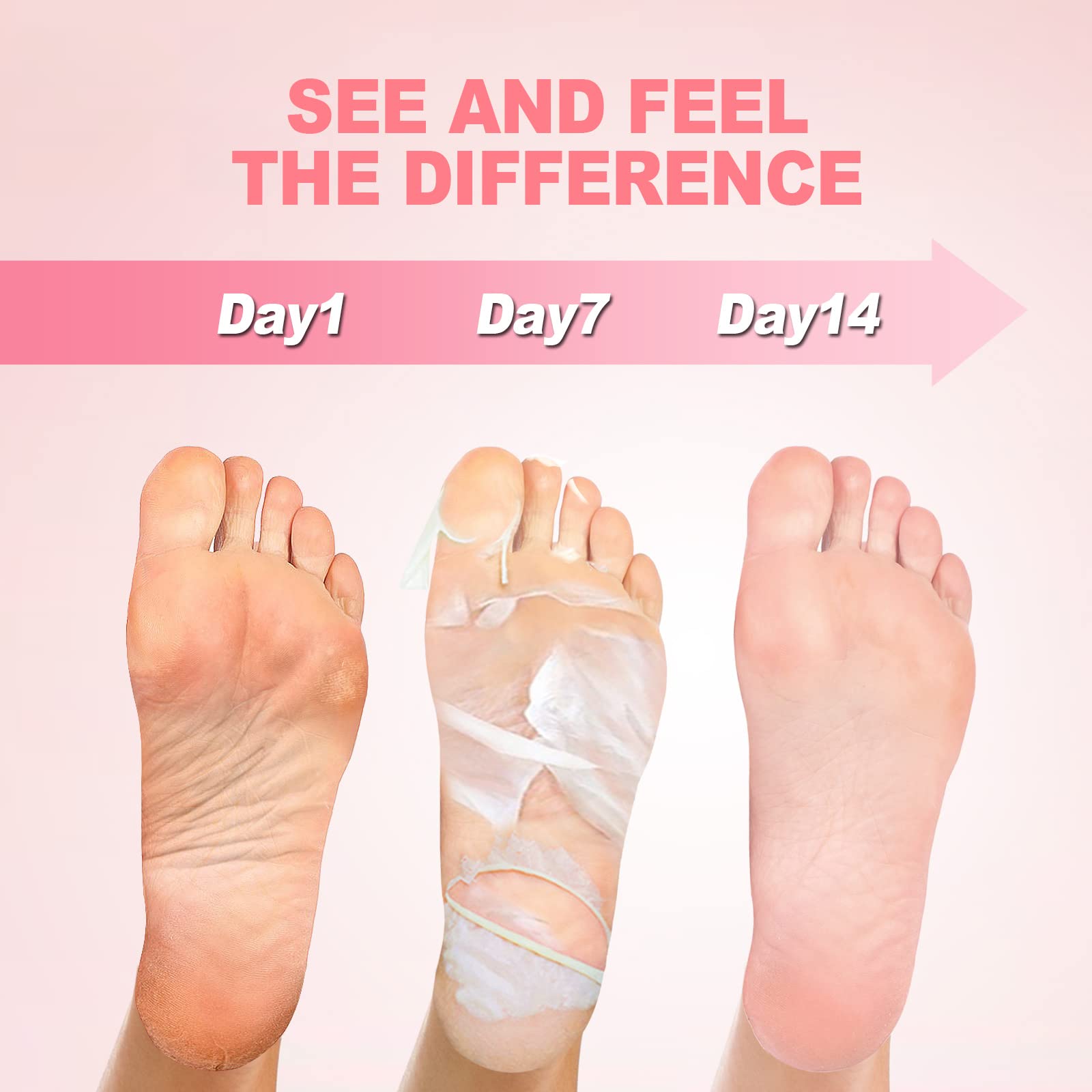 Maschera Esfoliante Piedi, 3 paia JVR Acido Lattico Maschera Peeling Piedi, riparazione tallone ruvido, rimozione della pelle morta, desquamazione di calli (Rosa)