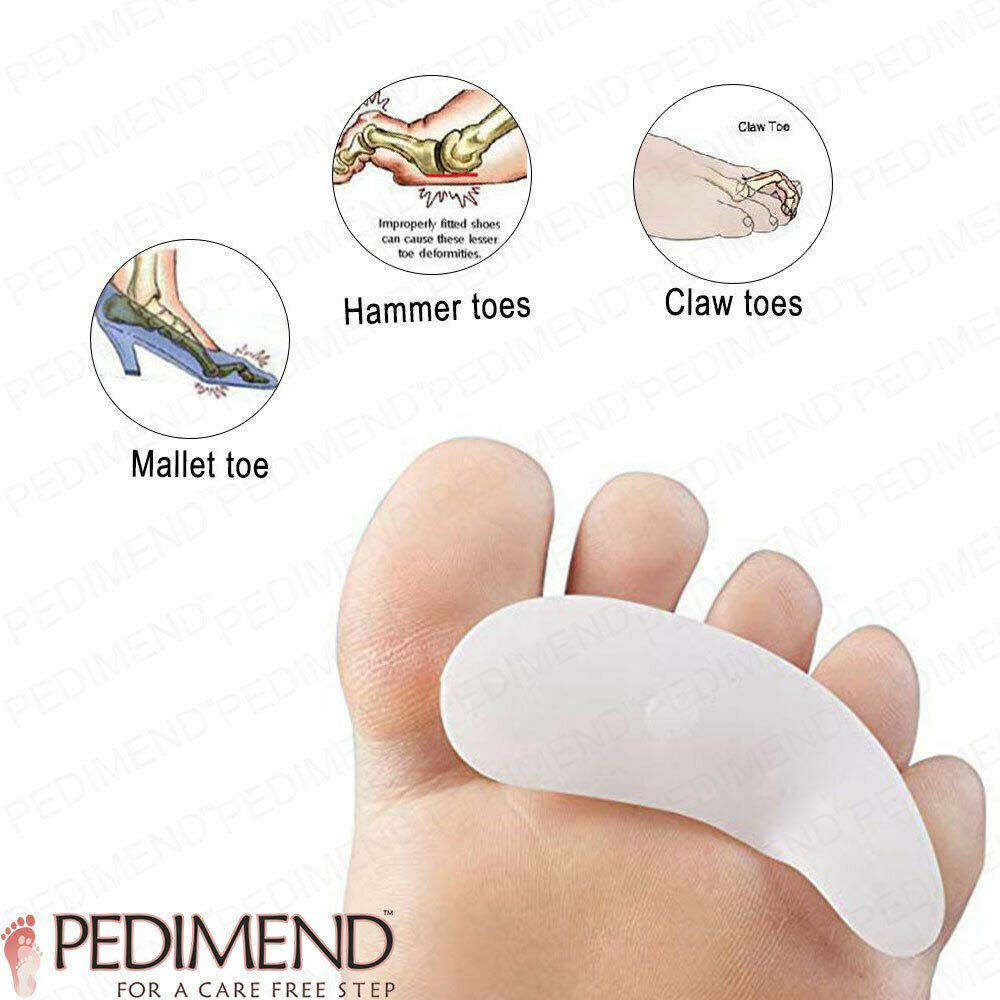 Pedimend Zehenspreizer für überlappende Zehen, Zehenstütze für Hammerzehen, Gel-Hammerzehen, 3 Paar