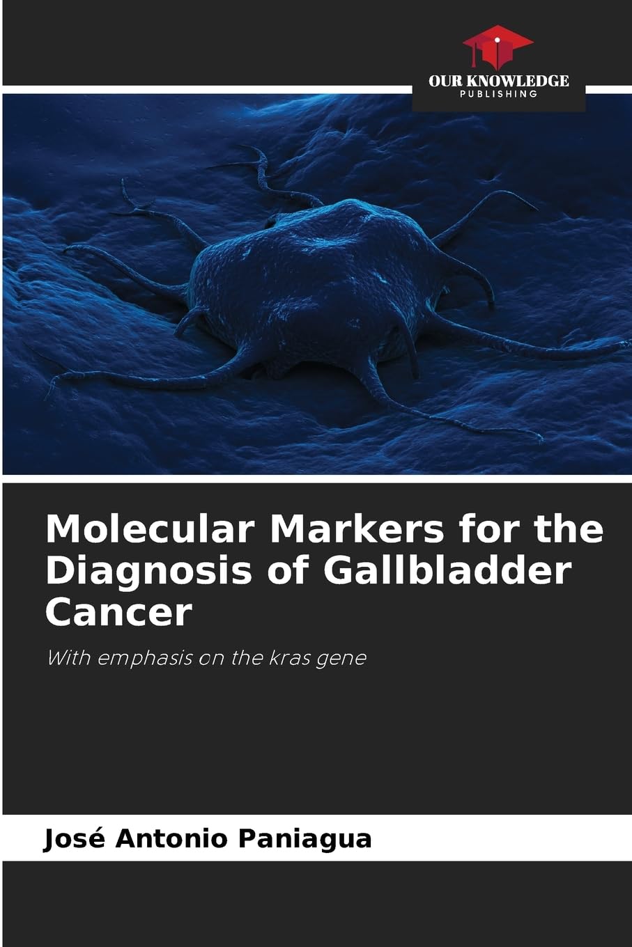 Molecular Markers for the Diagnosis of Gallbladder Cancer: With emphasis on the kras gene