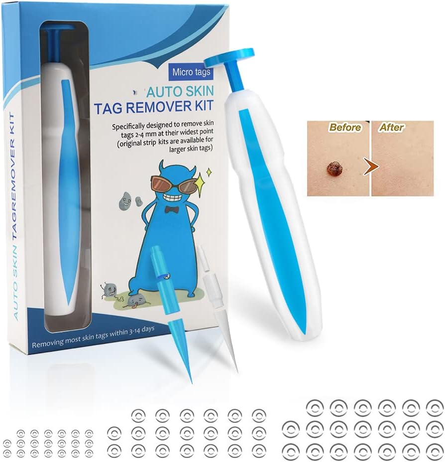 Skin Tag Remover, 2023 Upgrated Stielwarzen Entferner (12 mm kleines