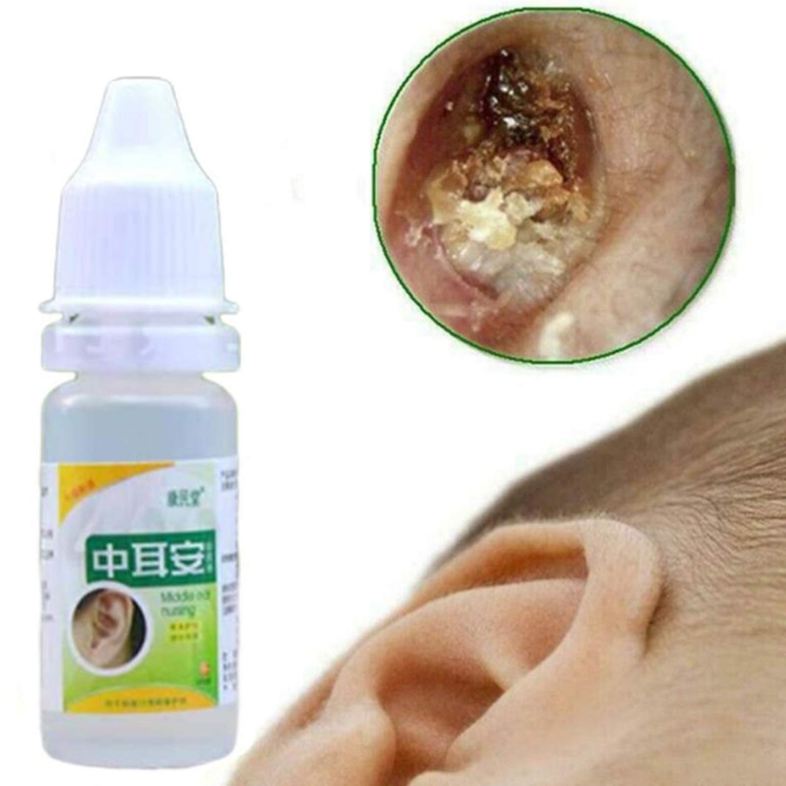 Xuebai 10ml Hierbas Chinas Gotas nutritivas para los oídos Otitis Media aguda Tinnitus sordera líquido de Limpieza Antibacteriano para aliviar el Dolor