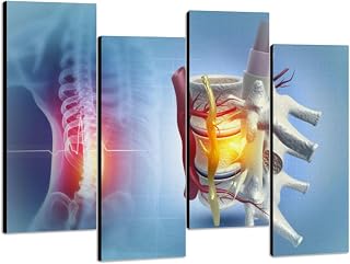 4Pcs Canvas Wall Art Human spinal cord injury back pain blurred 3d Photo Prints Realism Stretched and Framed Artworks Modern Wall Decor for Living Room Bedroom Office Clinic Hospital
