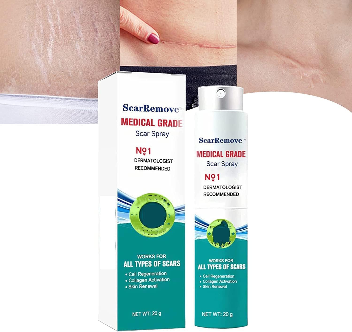 Scar Remove Medical Grade Scar Spray,Scar Removal Spray, Scar Remove Advanced Scar Spray,Advanced Acne Scar Treatment for Acne Scars,Surgical Scars (1 Pcs)