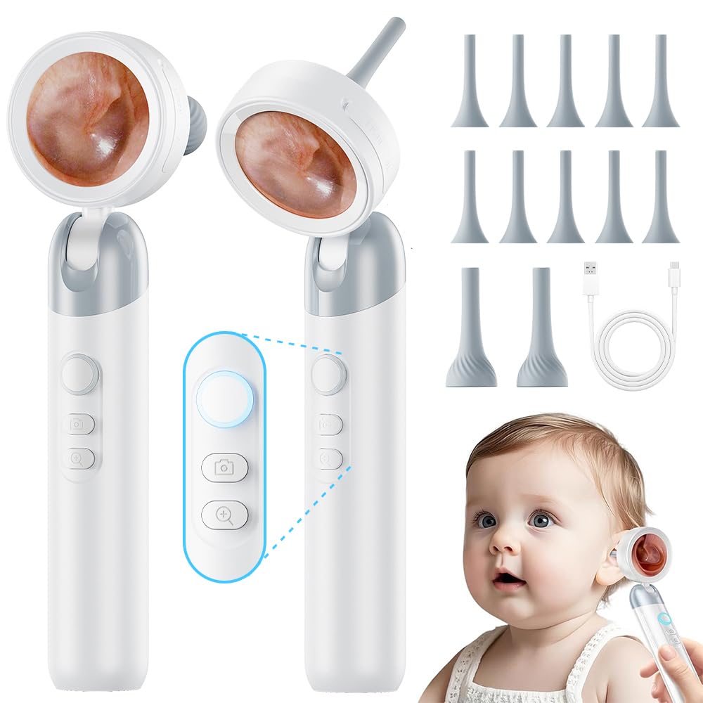 Aspoven Otoscope Ear Camera with Light, 1.4” Screen 1080P HD Ear Scope, 12 Silicone Specula Tips, Photo & Video Recording, Type-C Rechargeable, Ear