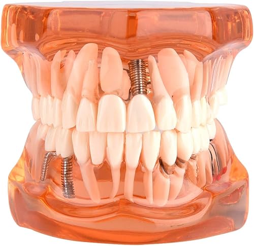 Modelo de enseñanza de los dientes de la enfermedad dental de la enfermedad dental extraíble del color naranja para el dentista y la escuela