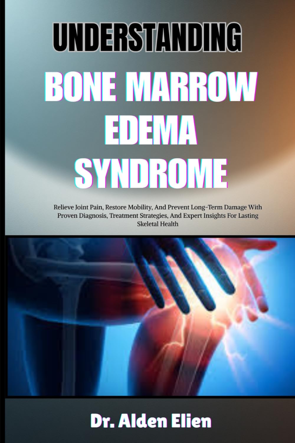 UNDERSTANDING BONE MARROW EDEMA SYNDROME: Relieve Joint Pain, Restore Mobility, And Prevent Long-Term Damage With Proven Diagnosis, Treatment ... Expert Insights For Lasting Skeletal Health
