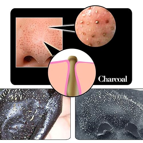 Miniatura 3 de SHILLS Máscara de carbón para hombres, máscara purificadora despegable, máscara facial, máscara facial de limpieza profunda, removedor de puntos