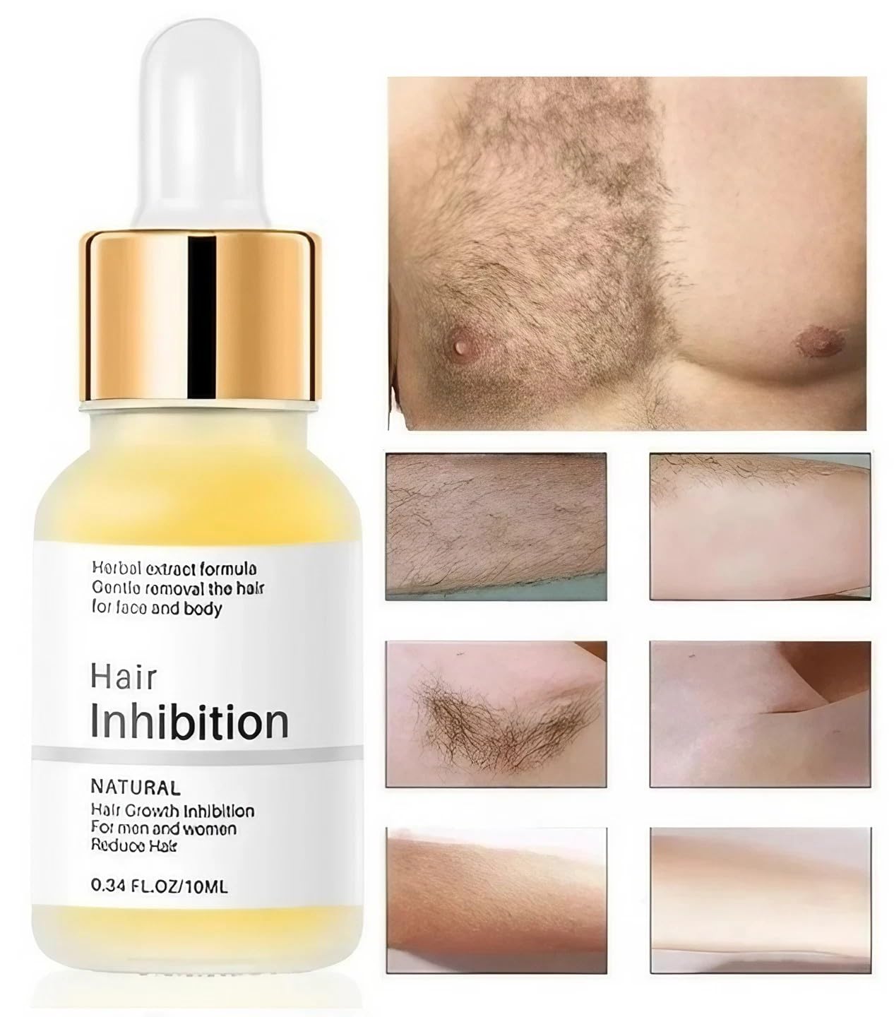 Anti-Nachwachs-Serum, Haarentfernungs-Serum für Damen und Herren, schmerzlos, schnelles Ergebnis, bekämpft eingewachsene Haare