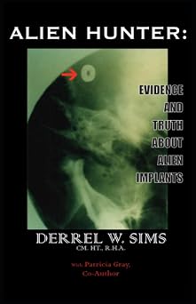 Alien Hunter Evidence and Truth about Alien Implants