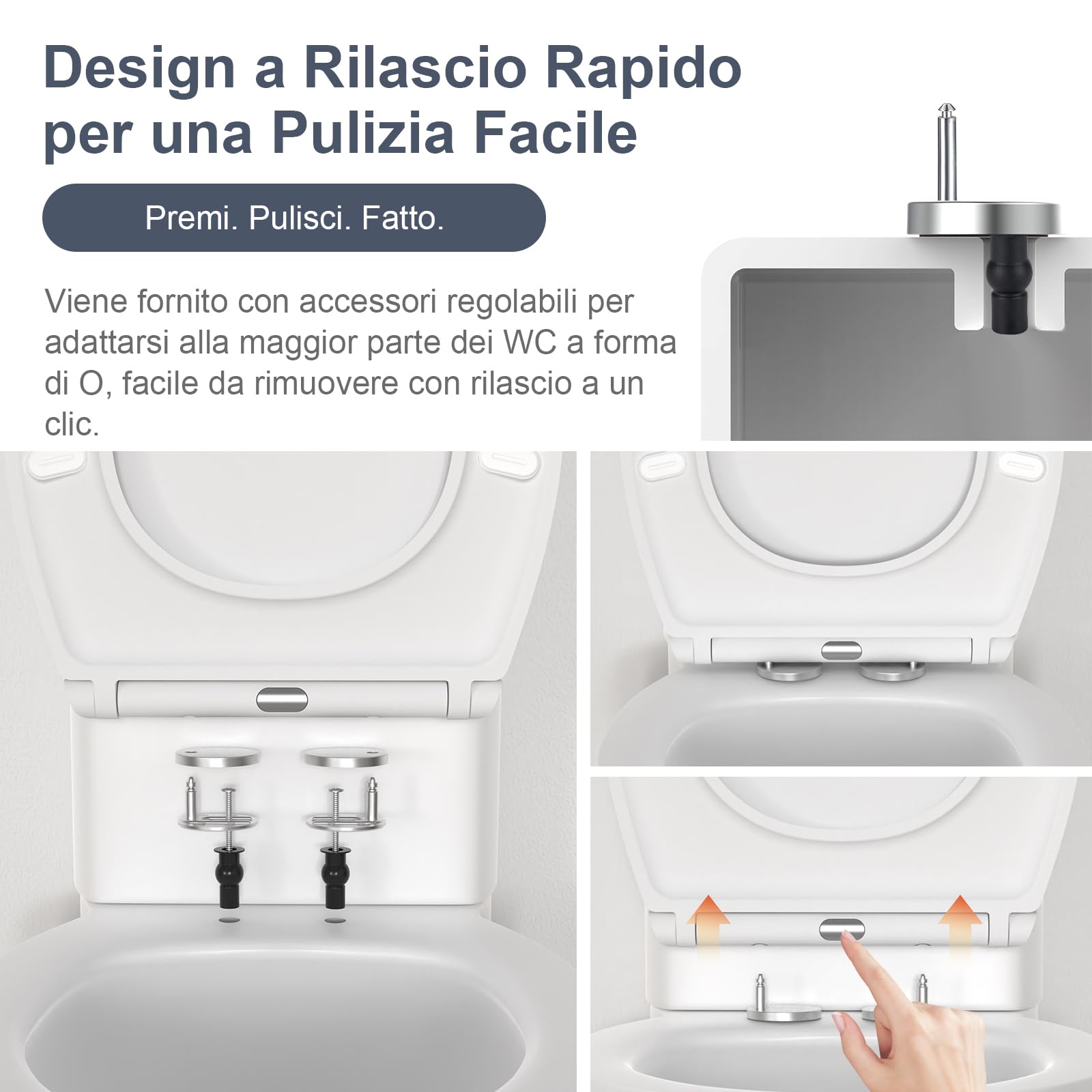 SURFOU Tavoletta WC con Chiusura Ammortizzata, Duroplast di Alta Qualità, Forma a O, Sgancio Rapido per Facile Pulizia, Supporta fino a 200 kg, con Gancetti in Gomma per Fissaggio Stabile