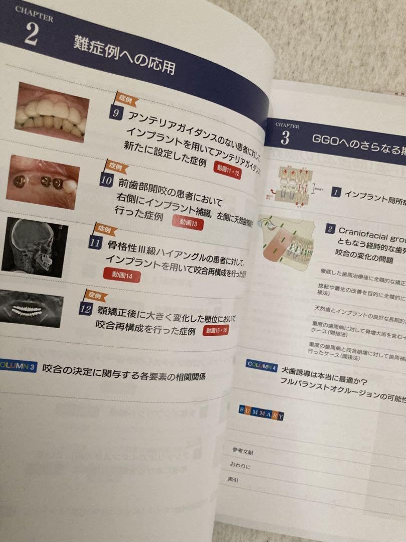 Amazon.co.jp: 患者一人ひとりに真に調和した咬合面のつくりかた