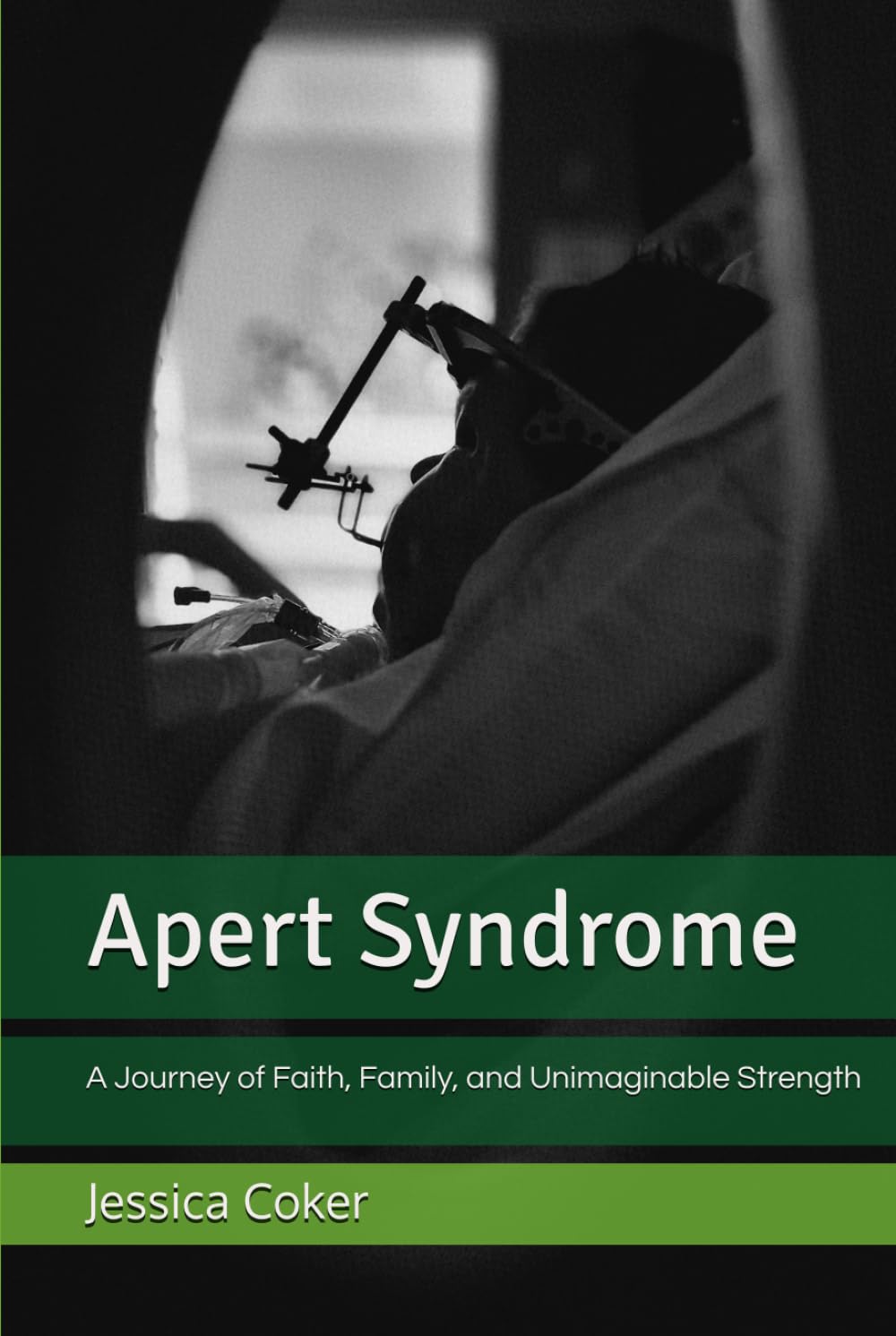 Apert Syndrome: A Journey of Faith, Family, and Unimaginable Strength