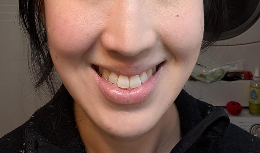 Review Image by Amazon Customer