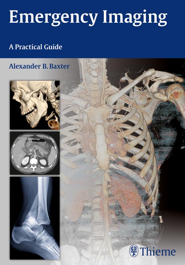 Emergency Imaging: A Practical Guide      1st Edition, Kindle Edition