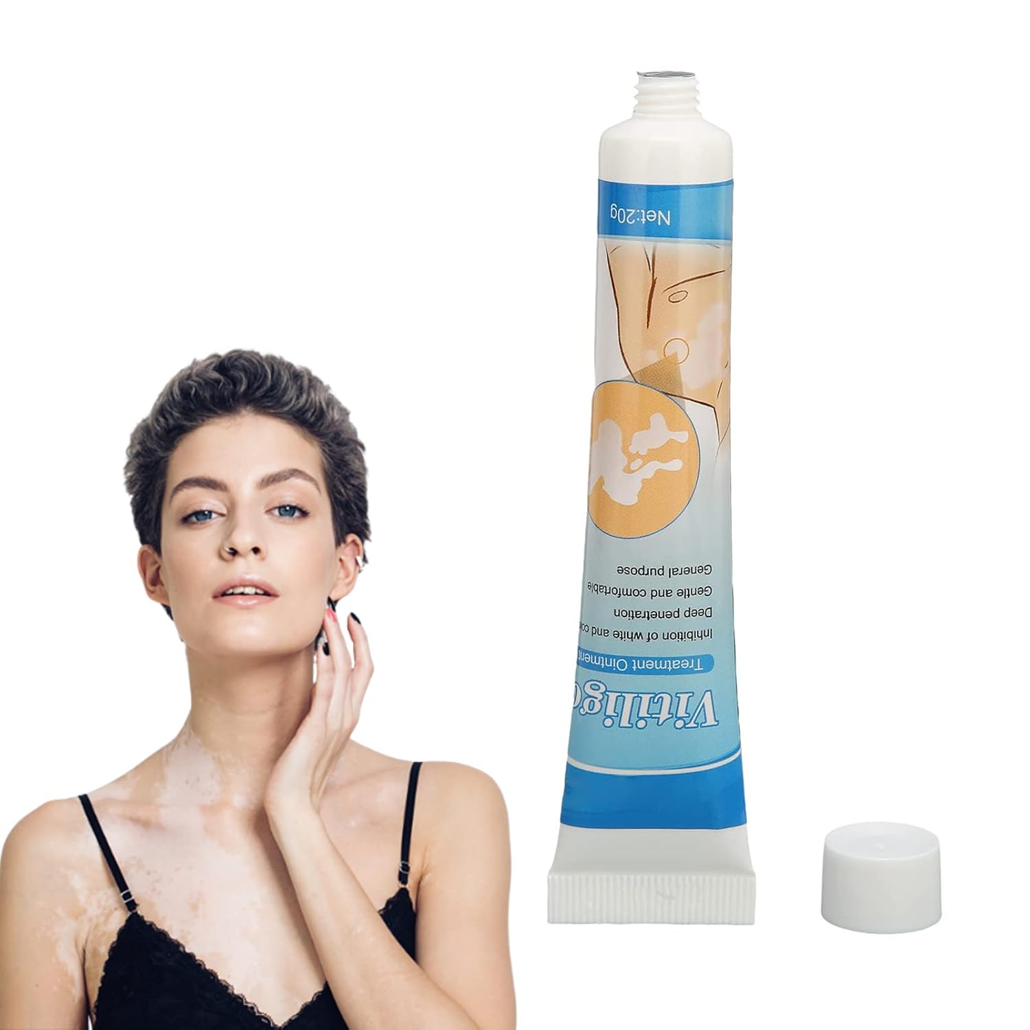 Vitiligo Cream Herbal Extract Ointment White Spot Treatment