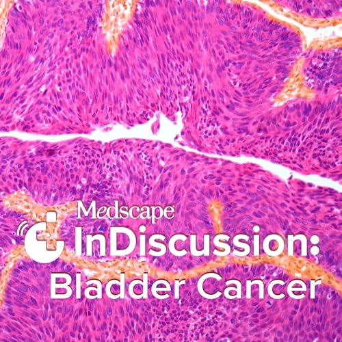 S1 Episode 1: Bladder Cancer Choices: Robotic or Open Cystectomy?