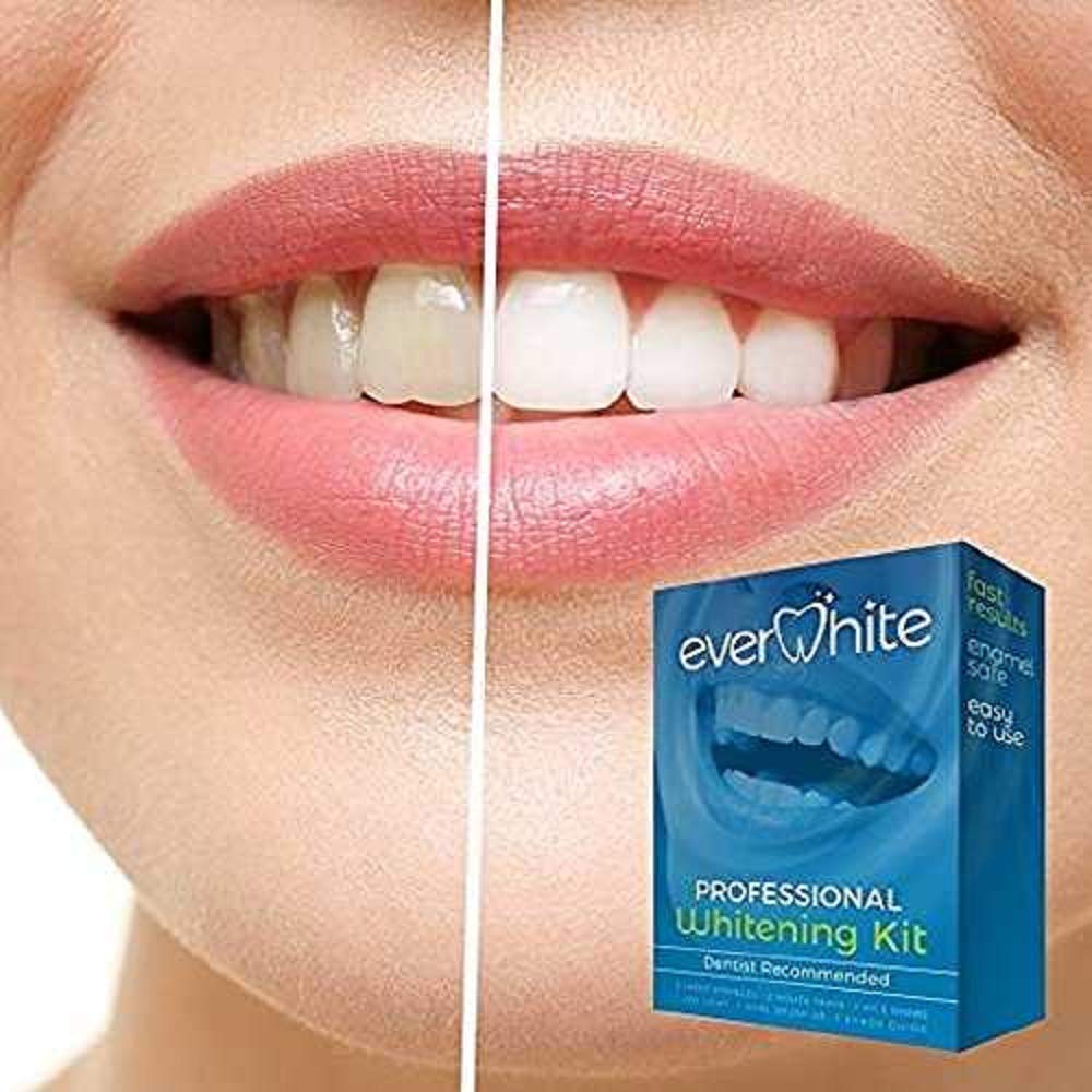 EverWhite At Home Professional Teeth Whitening Kit (10 pc)