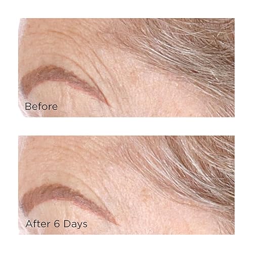 Miniatura 8 de Perricone MD Cold Plasma Plus + Máscara de hoja