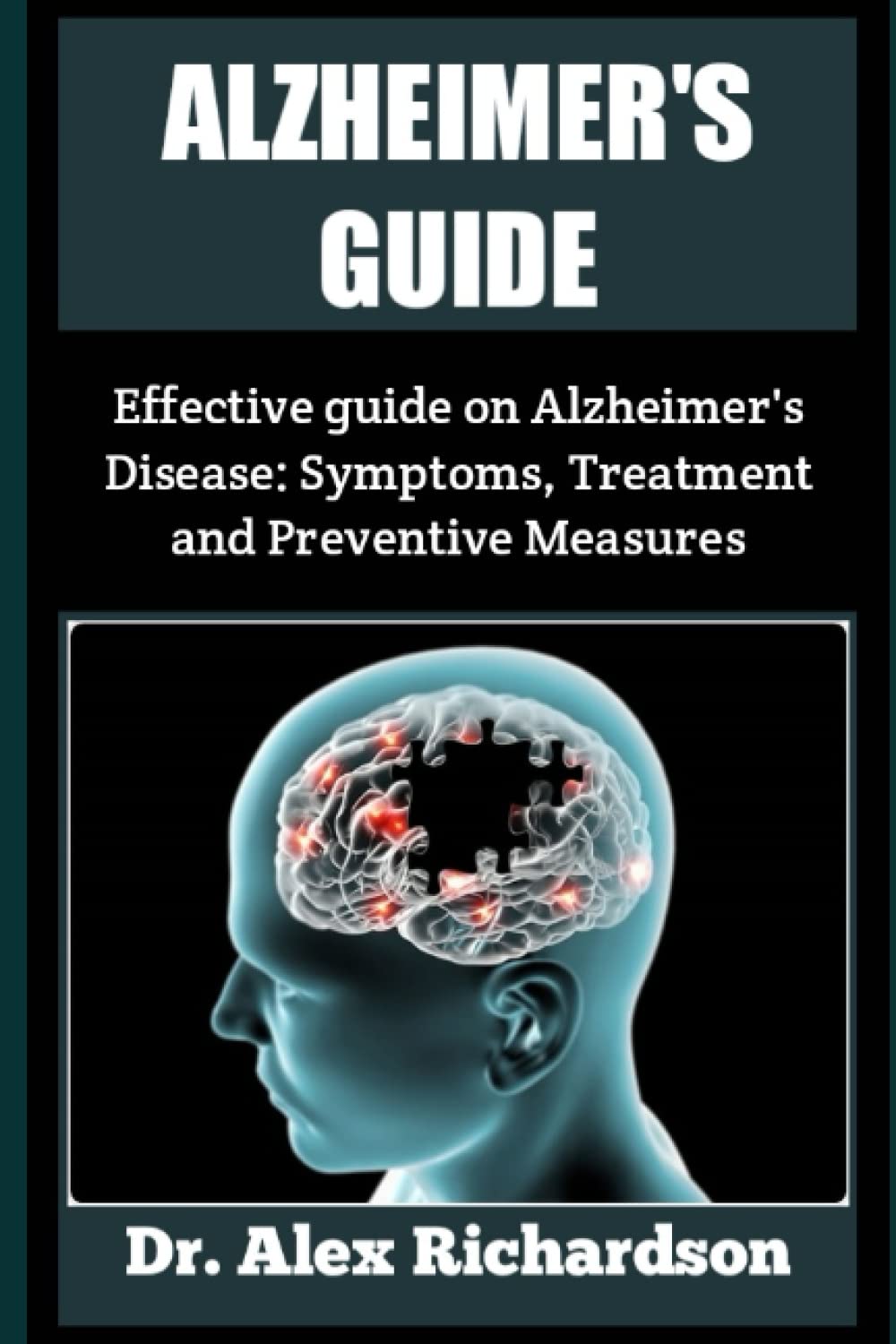 ALZHEIMER GUIDE: Effective Guide on Alzheimer’s Disease: Symptoms, Treatment and Preventive Measures