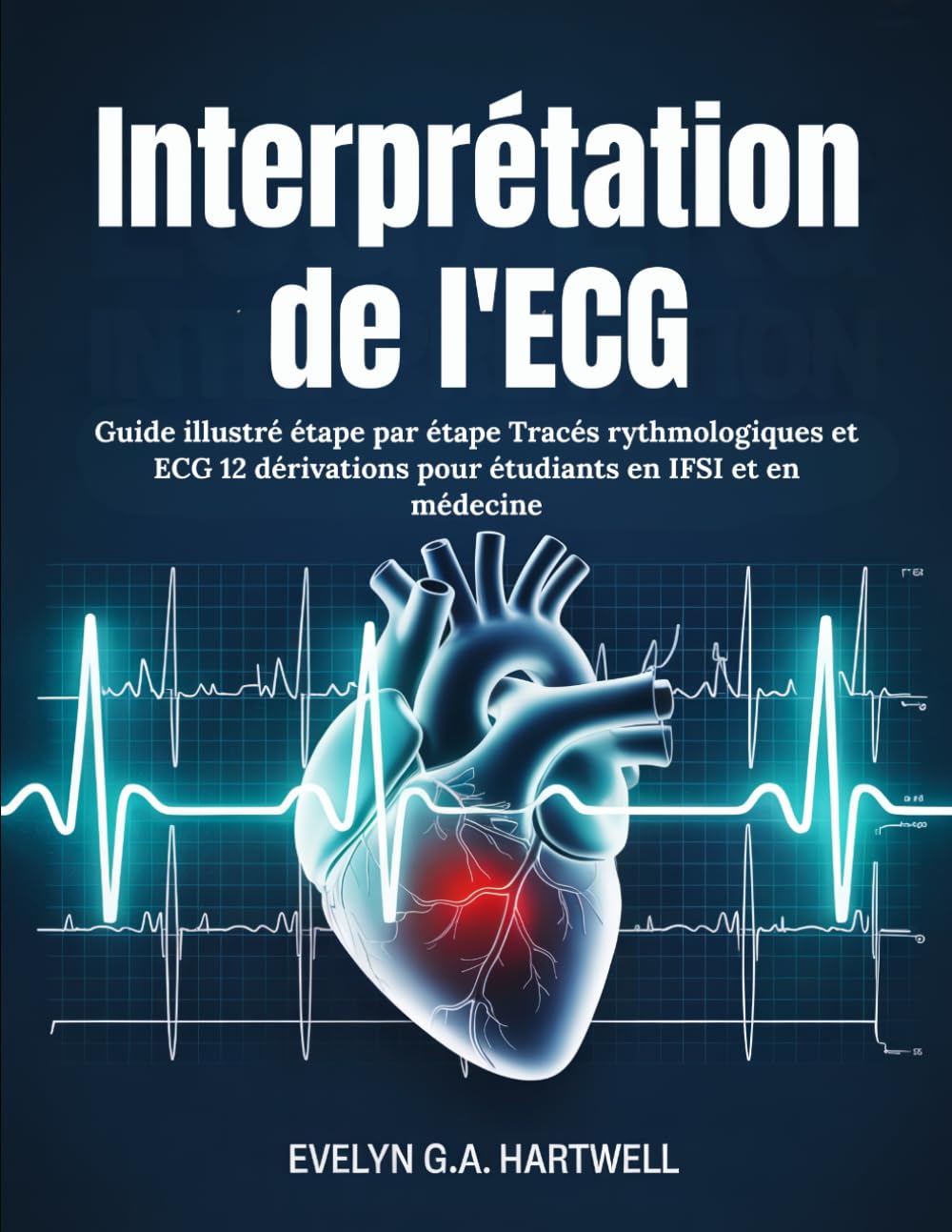 Interprétation de l'ECG: Guide illustré étape par étape Tracés rythmologiques et ECG 12 dérivations pour étudiants en IFSI et en médecine