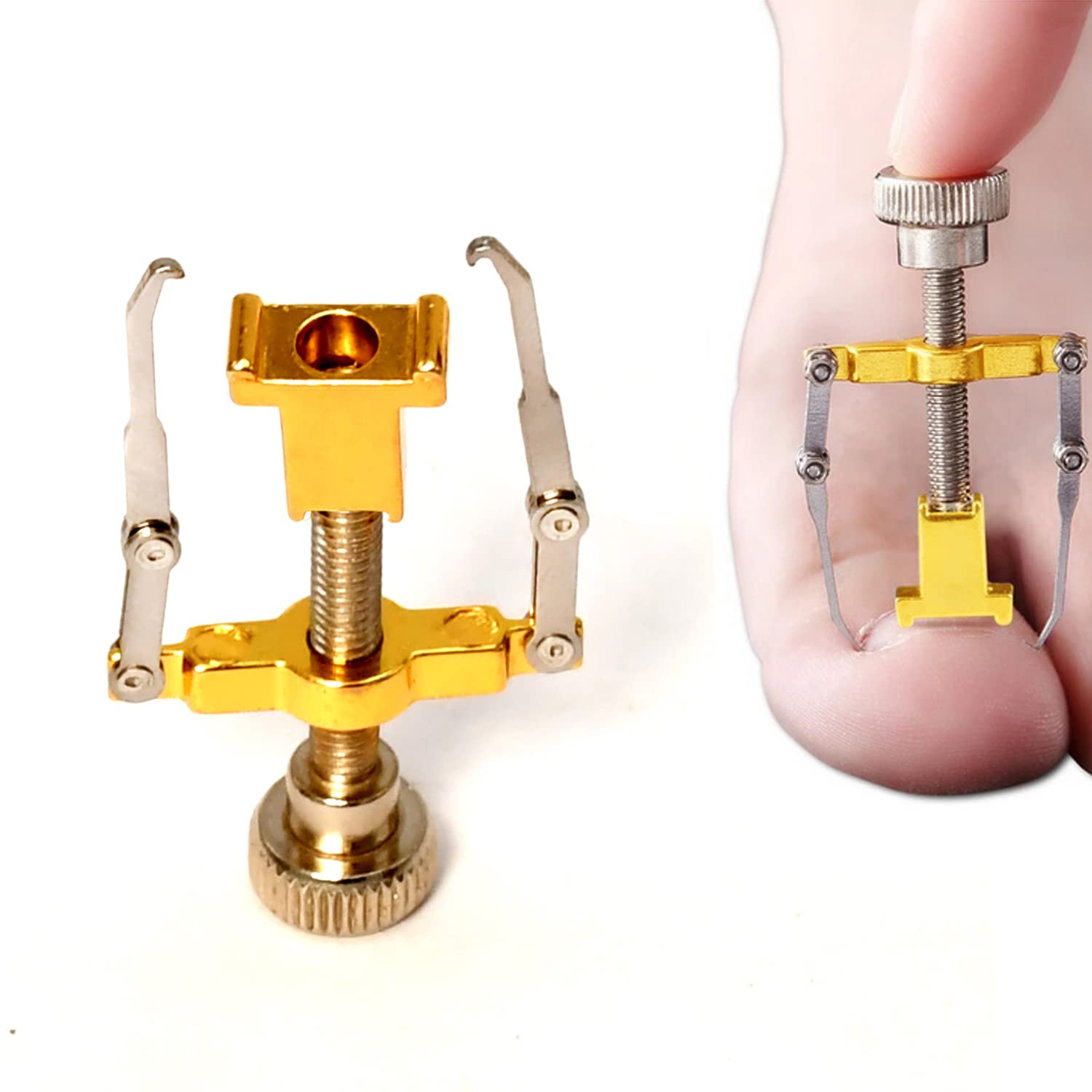 Odontomed2011 Correttore Dell'unghia Del Piede Incarnita Strumenti Di Pedicure In Acciaio Inossidabile Per Il Trattamento Corretto Dell'unghia Del Piede Incarnita, Strumenti Per Unghie Incarnite Manicure Clipper Pedicure Fixer NL-CTR-01-image