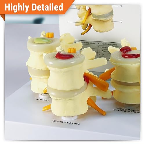 Miniatura 2 de Modelo de columna vertebral  Réplica de anatomía corporal humana de condiciones de vértebras de cuatro etapas para médicos herramienta educativa de