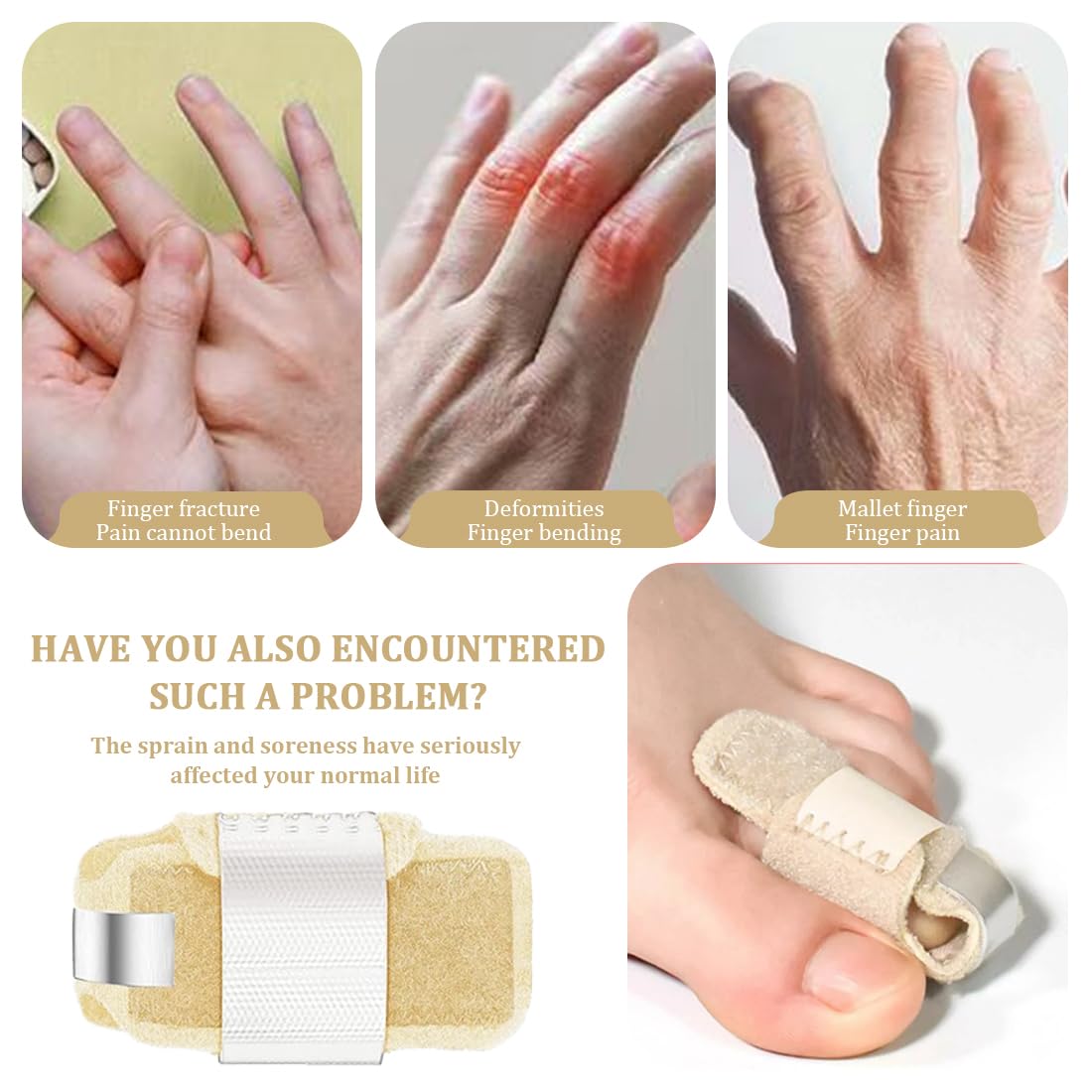 2Pcs Férula para Dedo en Martillo, Corrector Dedos del Pie, Soporte de Puntera Ajustable en Forma de U, Enderezador de Dedos de Los Pies, Para Fracturas de Dedos de Los Pies, Esguince, Martillo(Beige)