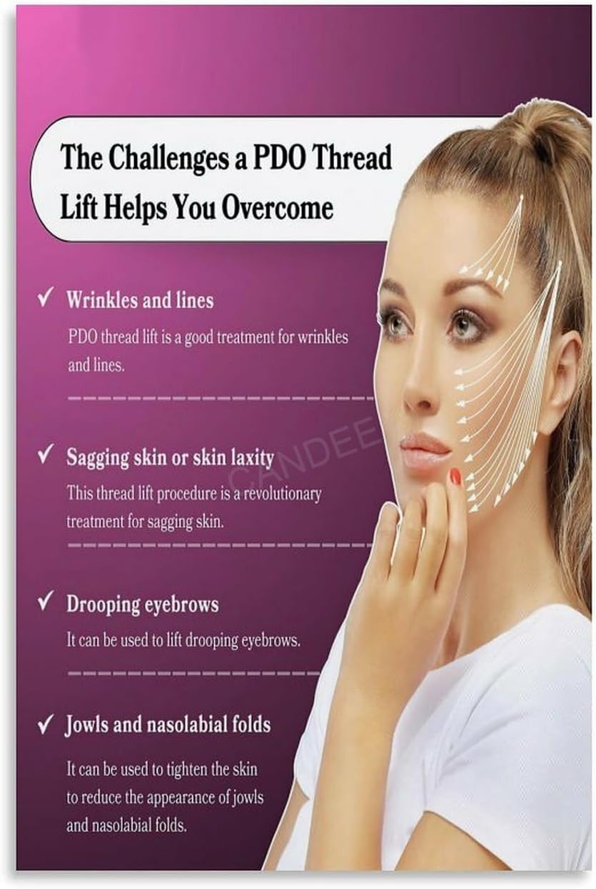 PDO Thread Lifts Poster The Secret to Natural-Looking Facelifts (7) Canvas Painting Wall Art Poster for Bedroom Living Room Decor 12x18inch(30x45cm) Unframe-style