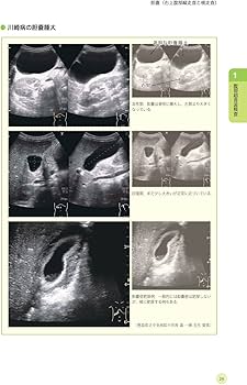 【裁断済】小児エコーの撮影法と正常・異常像がぜんぶわかる 2冊セット 裁断済】小児エコーの撮影法と正常・異常像がぜんぶわかる 2冊