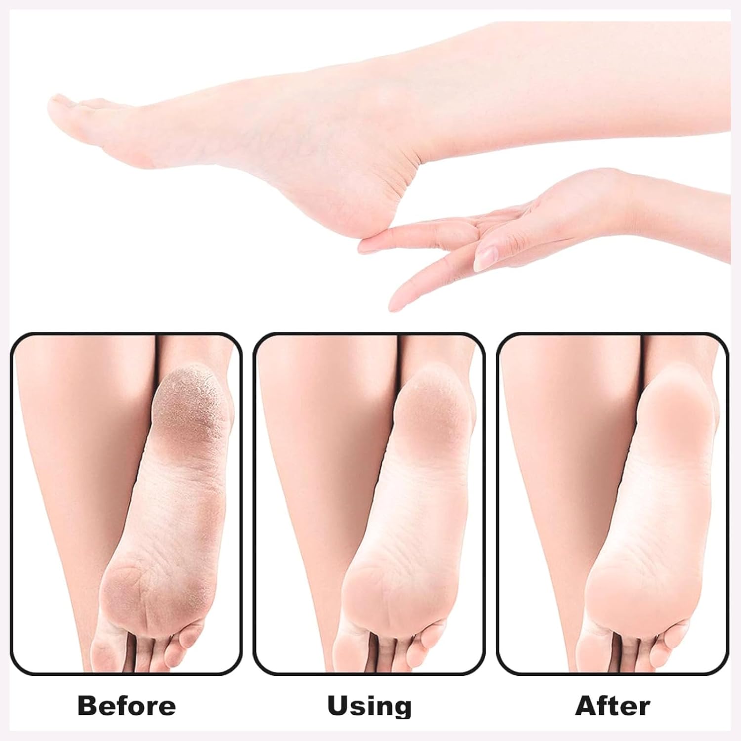 TRITON Professional Dual Sided Emery Coated Pedicure Foot Scraper Feet Filer for Dead Skin Removing Callus Remover Foot Scrubber_White