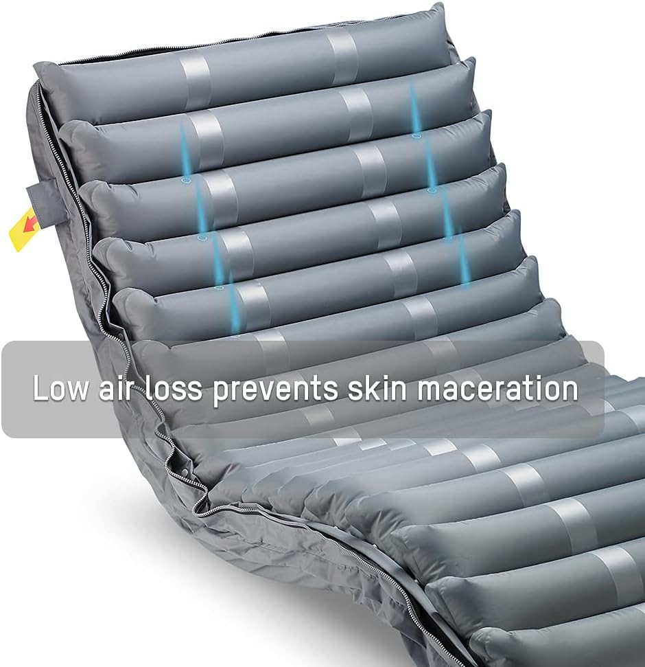Close-up of Apex Medical Domus 3 mattress showing low air loss ventilation.