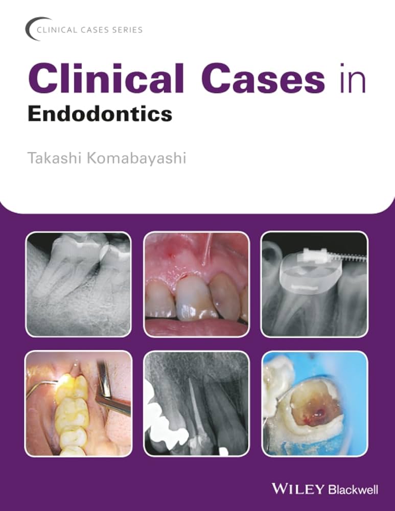 Clinical Cases in Endodontics (Clinical Cases (Dentistry