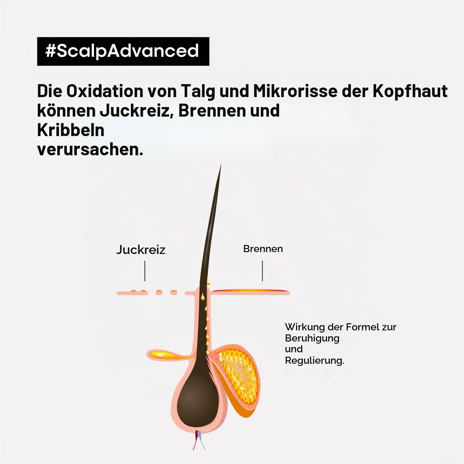 L'Oréal Professionnel Haarshampoo zur Beruhigung empfindlicher Kopfhaut, Scalp Advanced, Anti-Discomfort Dermo-Regulator Shampoo