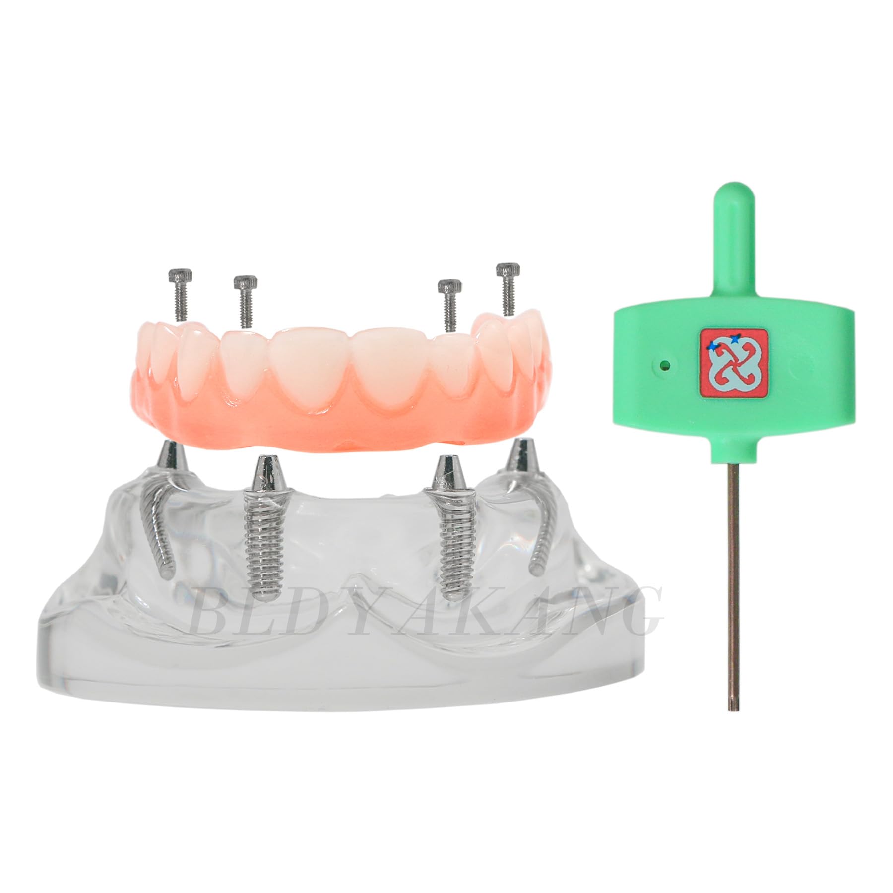 Dental Implant Upper Jaw All-on-4 Treatment Model, Detachable Overdenture