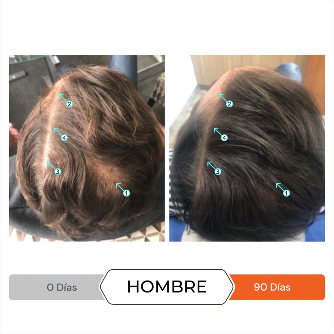 DS Laboratories Revita Champú para Adelgazamiento del Cabello - Apoya el Crecimiento, Fortalece y Espesa el Cabello - Sin Sulfato, Bloqueador de DHT (205 ml)