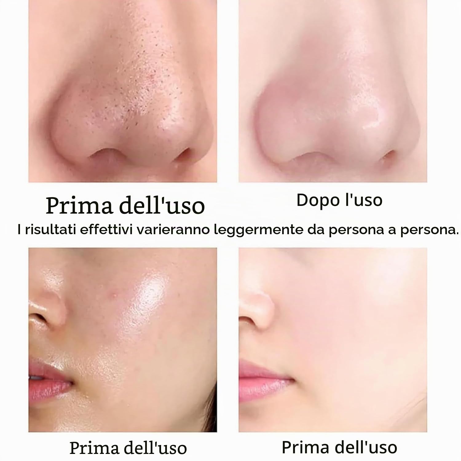 10 in 1 Macchina per la Bellezza per Viso – Idrodermoabrasione,Pulizia Profonda con Piccole Bolle,Ringiovanimento e Rassodamento,10 Testine,per Casa,Spa e Salone