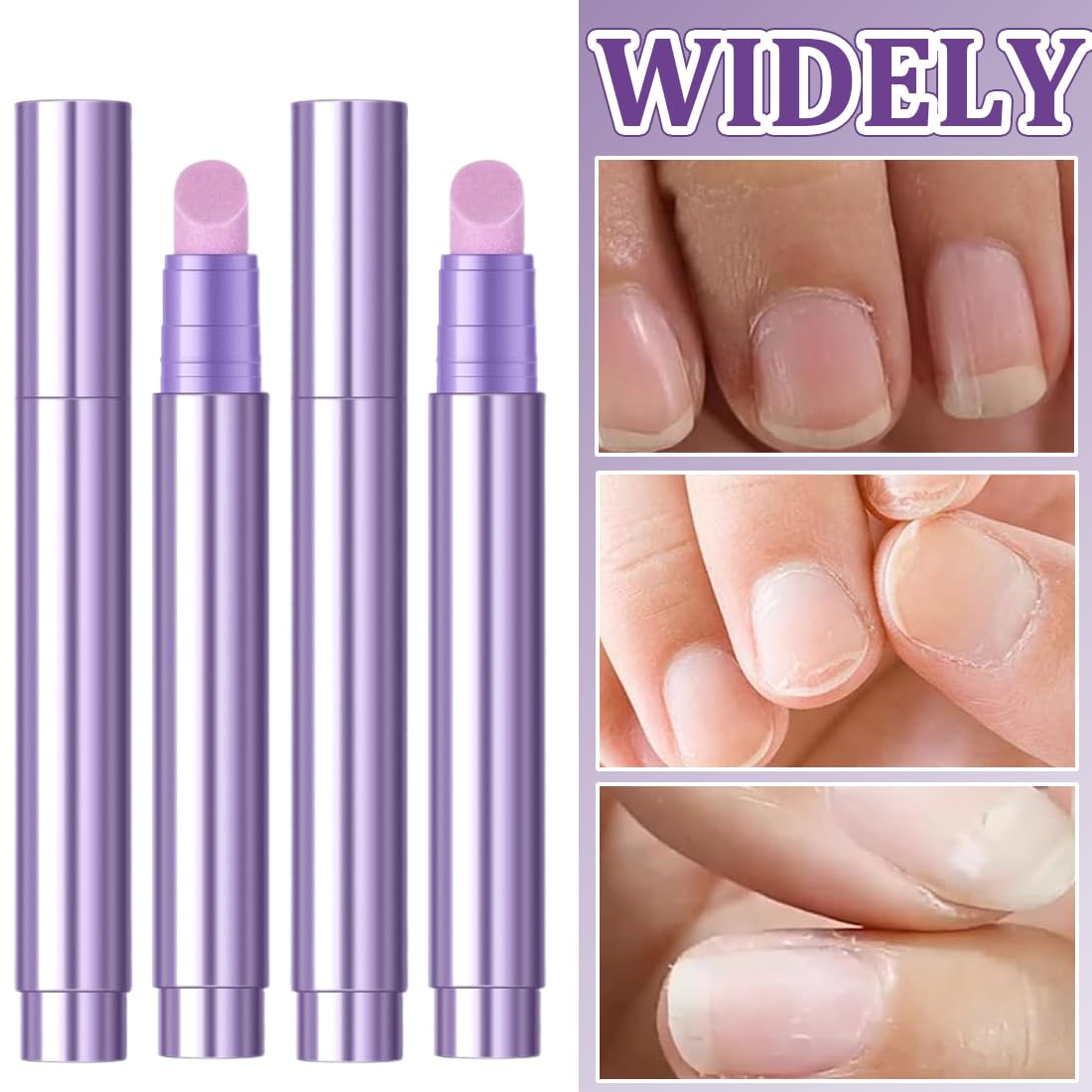 YAYNO 2 Pezzi Penna Con Olio Per Cuticole Penna 3 In 1 Per La Cura Delle Unghie Penne liquide per rimozione cuticole con corpo girevole Penne Con Punta In Ceramica Per Spingere Le Cuticole